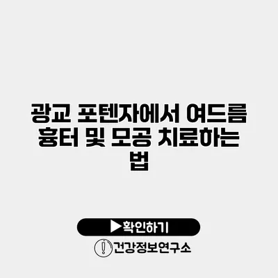 광교 포텐자에서 여드름 흉터 및 모공 치료하는 법