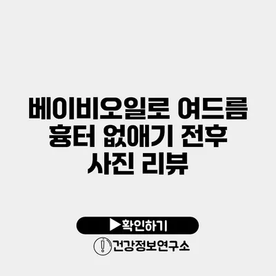 베이비오일로 여드름 흉터 없애기 전후 사진 리뷰