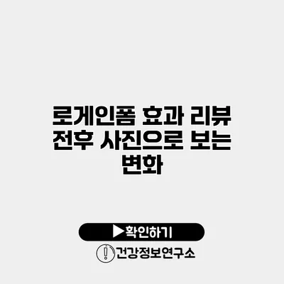 로게인폼 효과 리뷰 전후 사진으로 보는 변화