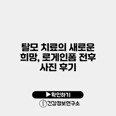 탈모 치료의 새로운 희망, 로게인폼 전후 사진 후기